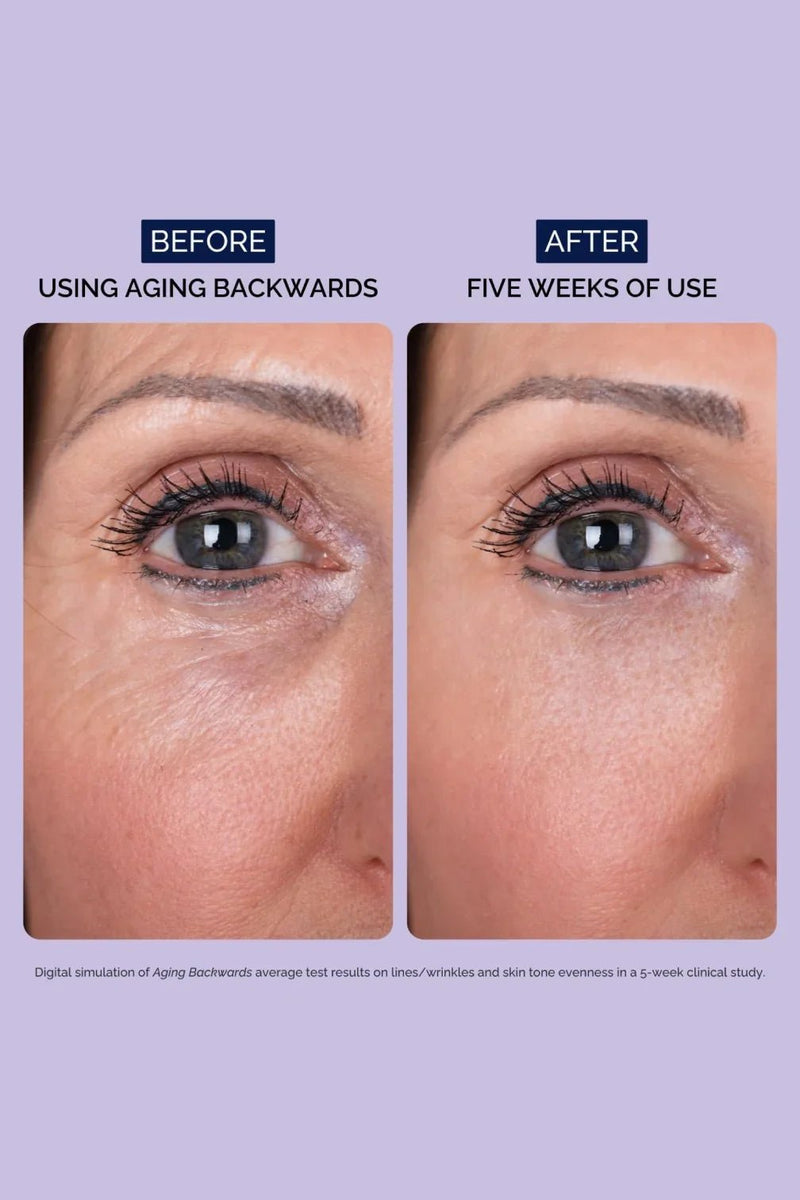 Aging Backwards™ — The All - in - One Retinol Night Cream That Keeps Working Even at 4 A.M - Sabbskin