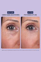 Aging Backwards™ — The All - in - One Retinol Night Cream That Keeps Working Even at 4 A.M - Sabbskin