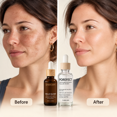 Melasma-Prone Skin