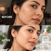 Porefect Niacinamide Toner - Sabbskin