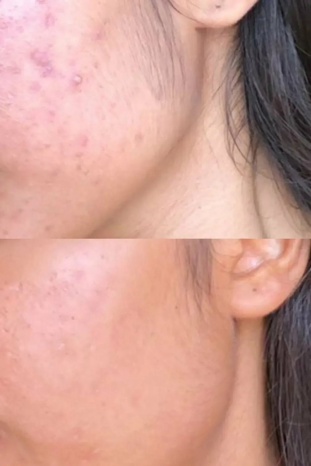 Porefect Niacinamide Toner - Sabbskin