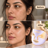 Skinimalist™ Yellow-First LED Face Mask - Sabbskin