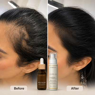 Thinning-Looking Hair